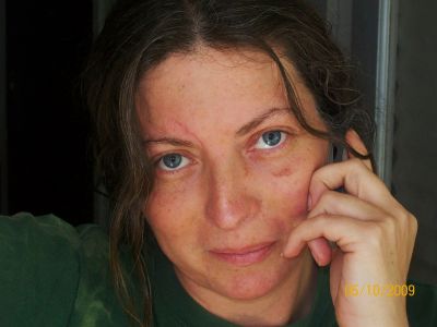 Linda Burton